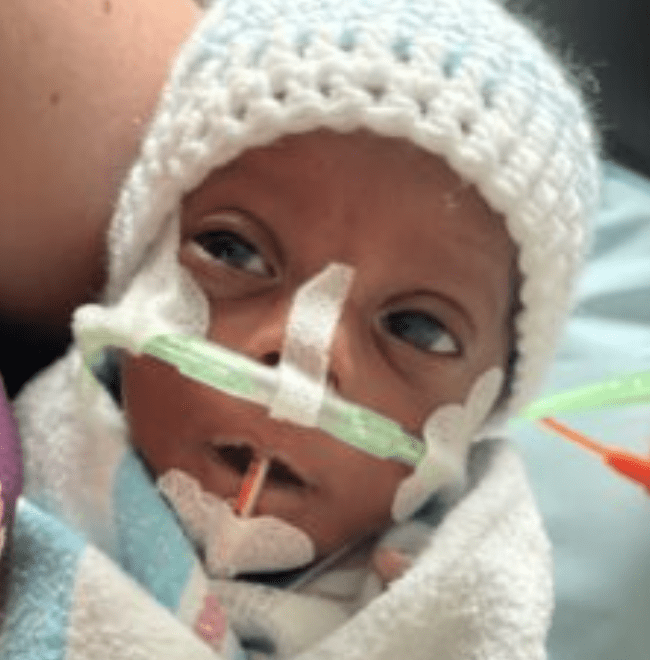 Read more about the article Our Littlest Baby Doing Well