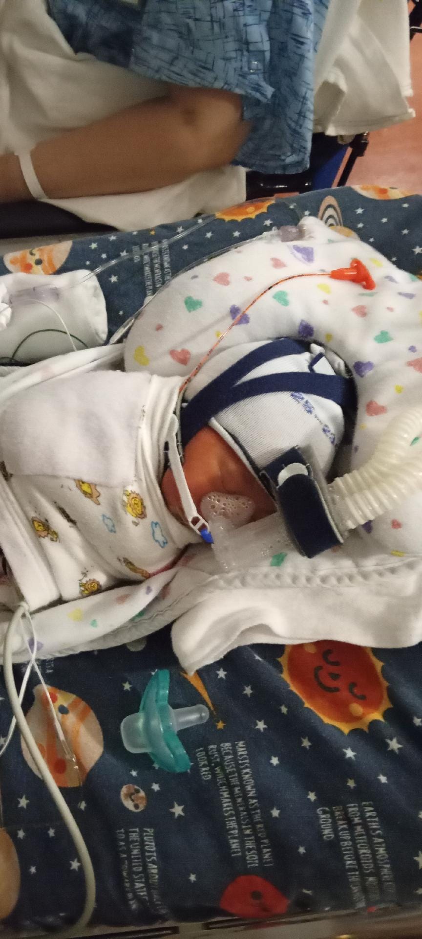You are currently viewing At Last the Parents Get to See His Face–Their Tiny NICU Baby
